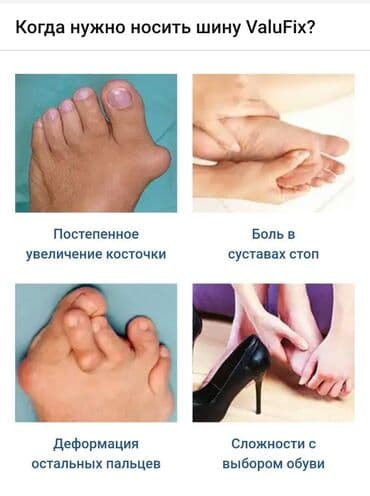 Кислородные подушки: Valufix- hallfix фиксатор от вальгусной деформации +бесплатная — 12