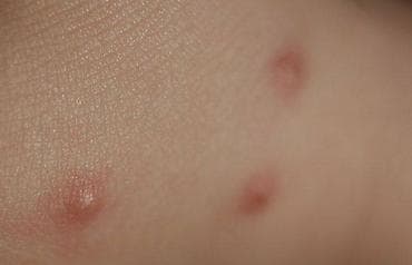 Клининговые услуги: Дезинфекция, дезинсекция, | Вирусы, микробы, Блохи, Клопы, | Подъезды, Дома, Кафе, магазины — 5