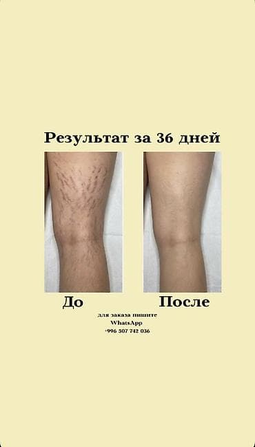 epix pro gen 2: Для улучшения кожи, Универсальный, Южная Корея, Капсулы, Новый — 2