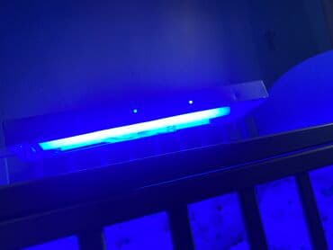 аренда лампа для лечения желтухи новорожденных: ‼️срочно продаю Фото лампа от желтухи. Покупали новый пользовались — 2