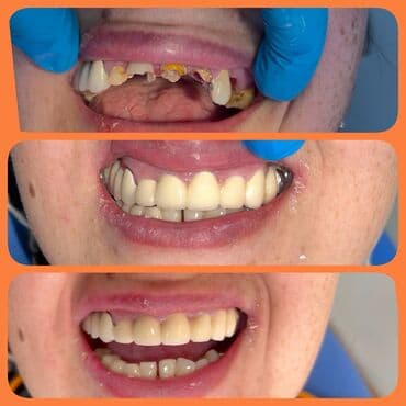 4 роддом бишкек цены: Врачи | Стоматолог | Протезирование — 4