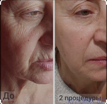 Косметология at lalafo.kg Косметология