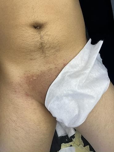 деревянный конструктор: Депиляция/ваксинг зоны подмышек - Удаление нежелательных волос — 8