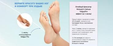 эспандер бабочка: Корректоры для большого пальца ноги от вальгусной деформации(косточки — 2