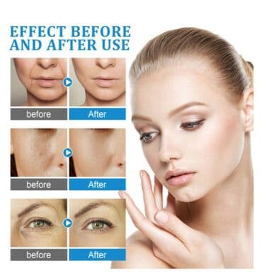 гиалуроновая кислота для суставов бишкек: ❄️ США Шоковое антивозрастное средство - гиалуроновая кислота — 2