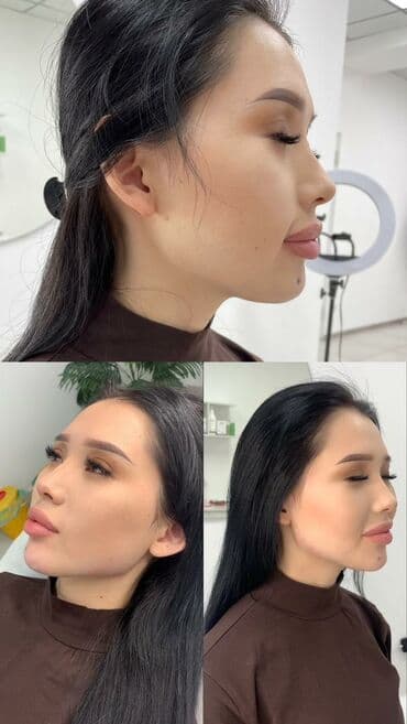 слива ферментированная капсула для похудения отзывы: Косметология, Биоревитализация, Контурное моделирование, Лечение угревой болезни, Сертифицированный косметолог — 2