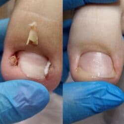 арендовать дом: Выравнивание, Услуги подолога, С выездом на дом, Консультация, Одноразовые расходные материалы — 17