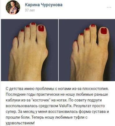 Кислородные подушки: Valufix- hallfix фиксатор от вальгусной деформации +бесплатная — 7