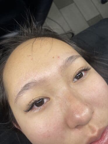 сколько стоит поставить брекеты на зубы в бишкеке: Наращивание ресниц - Классическое и объемное наращивание с — 2