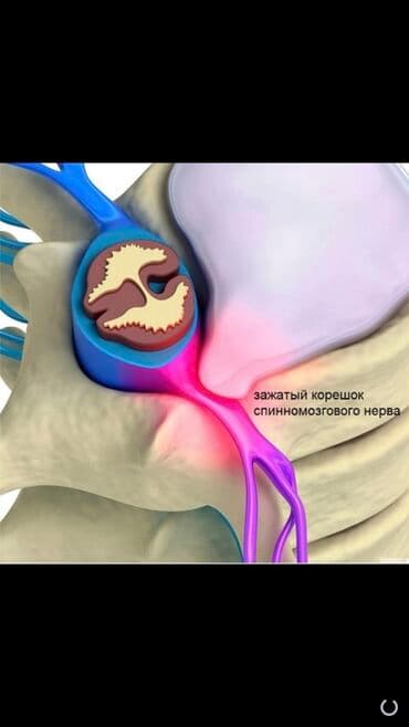 массаж швз: Массаж | Остеохондроз, Межпозвоночная грыжа, Протрузия | С выездом на дом, Консультация — 9