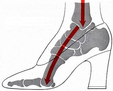стельки кожаные: Стельки ортопедические(специализированные) от плоскостопия! Для — 1