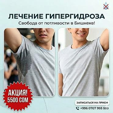Лечение гипергидроза — свобода от потливости в Бишкеке. - Современная