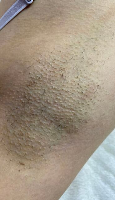 медсестра на дом бишкек мкр: Я мастер Ася 🍯 С опытом 3 года 🤝 Шугаринг Ламинирование бровей и — 17