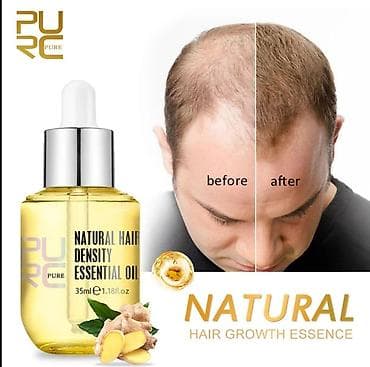 Натуральное эфирное масло для роста волос PURE. Экстракт имбиря