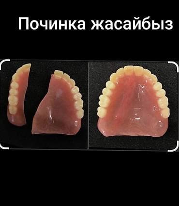 коробки упаковочные: Ремонт зубных протезов. Выполняется восстановление съемных зубных — 1