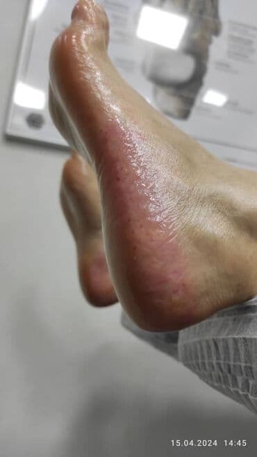 медсестра на дом бишкек мкр: Выравнивание, Наращивание ногтей, Донаращивание ногтей, Маникюр, Педикюр, Услуги подолога, С выездом на дом, Консультация, Одноразовые расходные материалы — 6