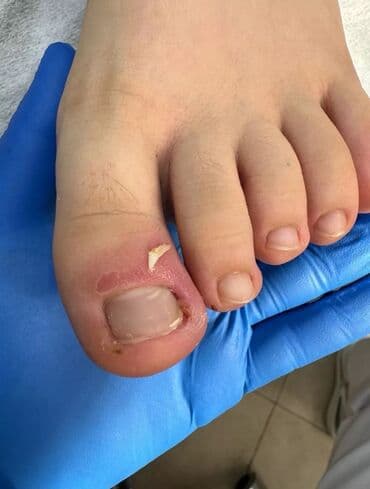 на дом керек: Услуги подолога, С выездом на дом, Консультация, Одноразовые расходные материалы — 2