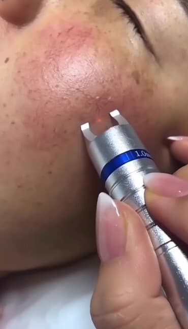 самый лучший эндокринолог рядом просп жибек жолу бишкек: Косметология, Ботокс, Биоревитализация, Ботулинотерапия, Консультация, Гипоаллергенные материалы, Сертифицированный косметолог — 1