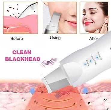 Ультразвуковой скрабер для лица (Ultrasonic Skin Scrubber) — at lalafo.kg Ультразвуковой скрабер для лица (Ultrasonic Skin Scrubber) —