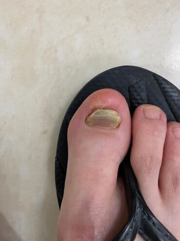 самый лучший эндокринолог рядом просп жибек жолу бишкек: Воосшие ногти, заболевания ногтей, стопы, бородавки, мозоли — 14