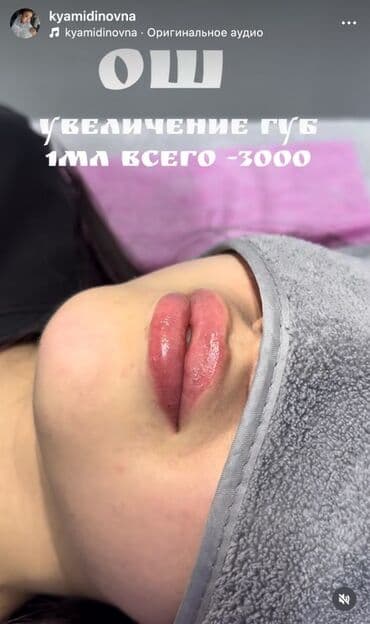 лэшмейкер обучение с трудоустройством: Косметология, Увеличение губ, Консультация — 1