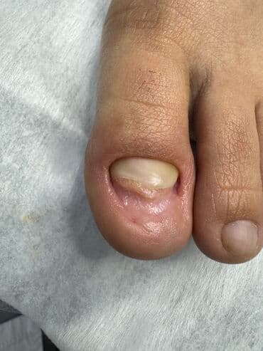 самый лучший эндокринолог рядом просп жибек жолу бишкек: Наращивание ногтей, Укрепление ногтей, Ремонт сломаных ногтей, Маникюр, Педикюр, С выездом на дом, Консультация, Одноразовые расходные материалы — 7