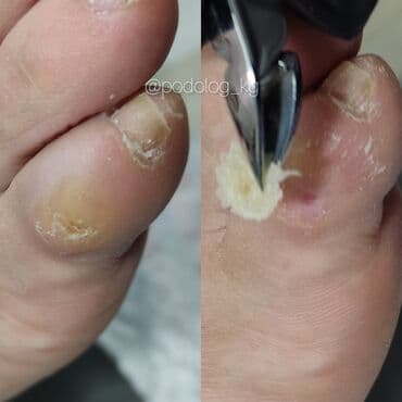 сколько стоит обучение на мастера маникюра: Коррекция вросших ногтей, Маникюр, Педикюр, Услуги подолога, Консультация — 7