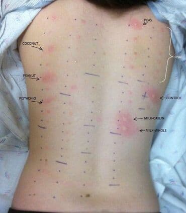 каркасные дома проекты и цены бишкек: Уничтожения клоповДезинфекция!!!любой сложности (*❛‿❛)→Приемлемая — 15