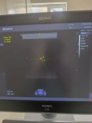 Пульсоксиметры: Ультразвуковая диагностическая аппарат 2024 года выпуска - — 3