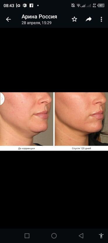 самый лучший эндокринолог рядом просп жибек жолу бишкек: Косметология, Ботокс, Восстановление объема губ, Лифтинг нити, С выездом на дом, Консультация, Гипоаллергенные материалы — 2