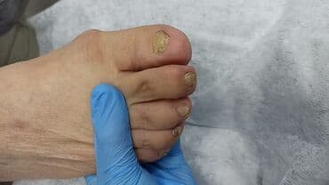 сколько стоит обучение на мастера маникюра: Выравнивание, Наращивание ногтей, Донаращивание ногтей, Маникюр, Педикюр, Услуги подолога, Консультация, Одноразовые расходные материалы — 3