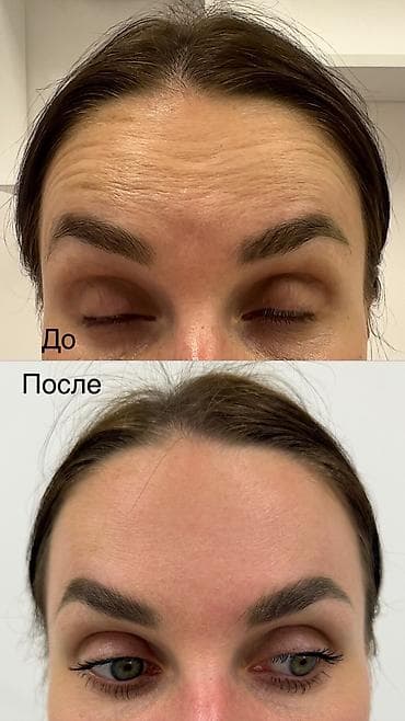 красотки мужские: Косметология, Ботокс, Сертифицированный косметолог — 2