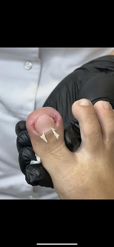 медицинские обуви: - Медицинский педикюр и мужской маникюр: обработка кутикулы — 1