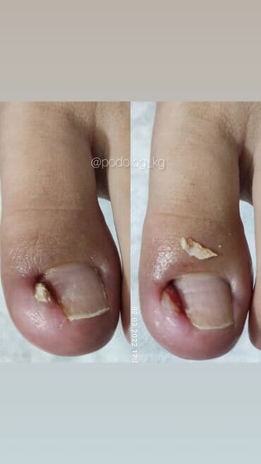 сколько стоит обучение на мастера маникюра: Коррекция вросших ногтей, Маникюр, Педикюр, Услуги подолога, Консультация — 6