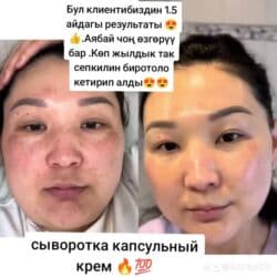 h2 premium магний водород инструкция: Так,сепкил,куперез и бырышка 👍🔥Самый эффективный сыворотка крем 💯 — 23