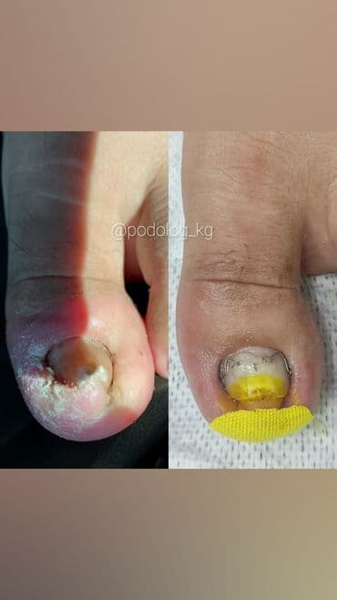 сколько стоит обучение на мастера маникюра: Коррекция вросших ногтей, Маникюр, Педикюр, Услуги подолога, Консультация, Одноразовые расходные материалы — 12