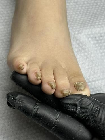 g pro: Коррекция вросших ногтей, Педикюр, С выездом на дом, Консультация, Одноразовые расходные материалы — 3