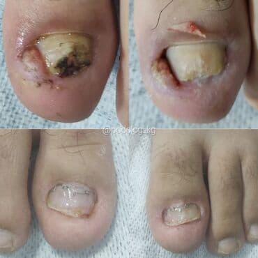 сколько стоит обучение на маникюр: Коррекция вросших ногтей, Услуги подолога, Педикюр, Одноразовые расходные материалы, Консультация — 10