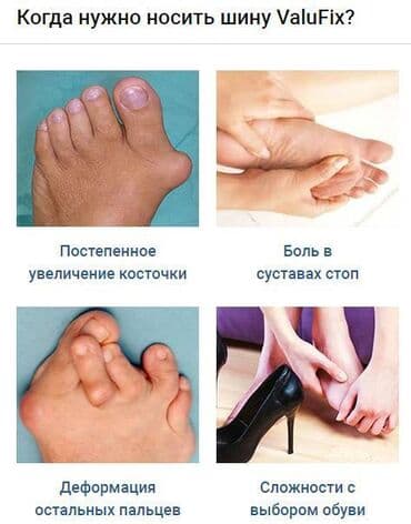 Кислородные подушки: Valufix- hallfix фиксатор от вальгусной деформации +бесплатная — 4