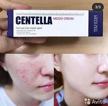 cream: Успокаивающий крем с экстрактом центеллы для чувствительной — 2