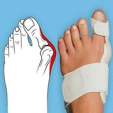 Ортопедическая шина HALLUFIX Адрес: Лермонтова