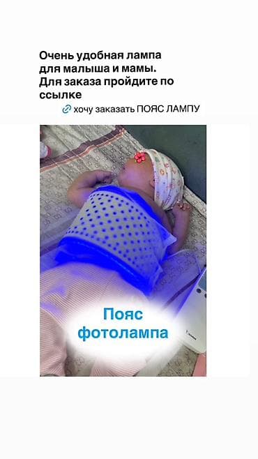 коляса: Аренда фотоламп для новорождённых (терапия неонатальной желтухи) — 8