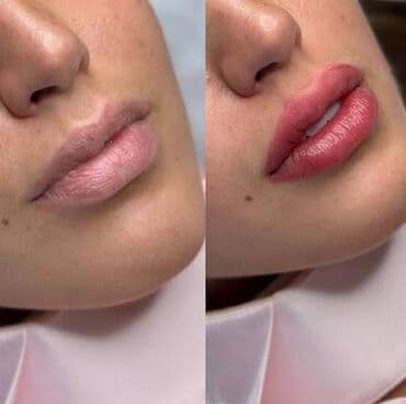 накладные брекеты для красоты купить: Ищем модедей на Перманентный макияж губ (акварельное напыление) - — 1