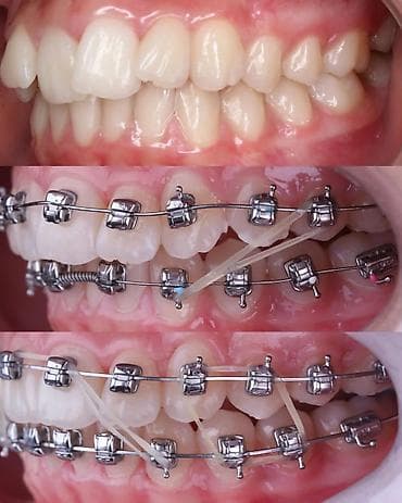 ортопедическое кресло бишкек: Скамейка Металл — 7