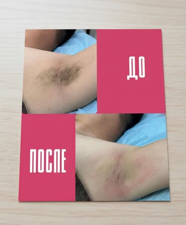 садовые работы: Г.Ош,Шугаринг на все зоны для мужчин!Избавьтесь от лишних и — 2