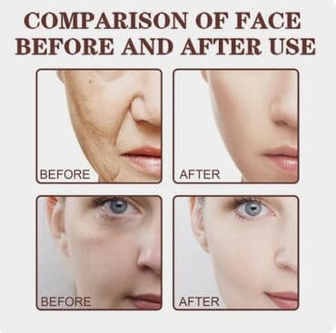 Киреге берилүүчү кийимдер: США Крем укрепляющий с черным чаем и решение 5 проблем кожи — 5