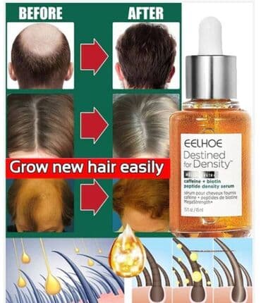 шампунь дисаар: ❄️ США От выпадения волос от облысения от алоп еции для густоты волос — 7