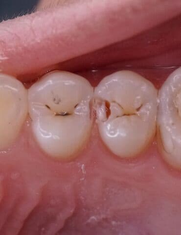 лучший детский стоматолог бишкек: Стоматолог Бишкек. Профессиональная чистка. Лечение кариеса и его — 6