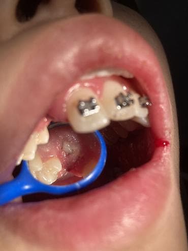 ортопедическое кресло бишкек: Скамейка Металл — 10