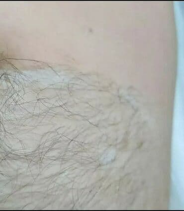 самый лучший эндокринолог рядом просп жибек жолу бишкек: Шугаринг для мужчин.сахар,воск. Это не салон красоты, отдельный — 4